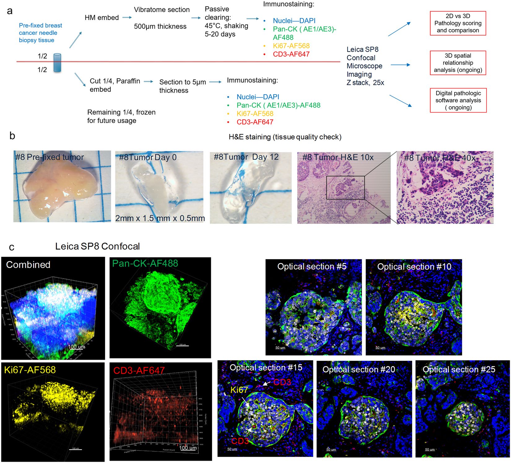 A schematic workflow diagram of CLARITY tissue processing, clearing, immunostaining, and imaging for the pre-fixed clinical biopsy samples of human breast cancer tissue