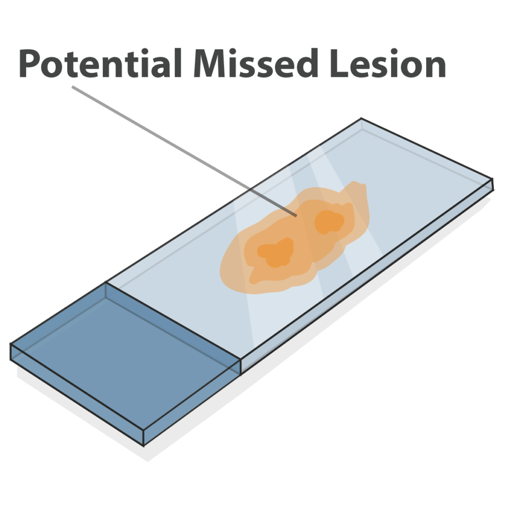 FFPE Slide 2D Tissue Sample With Potential Missed Lesion