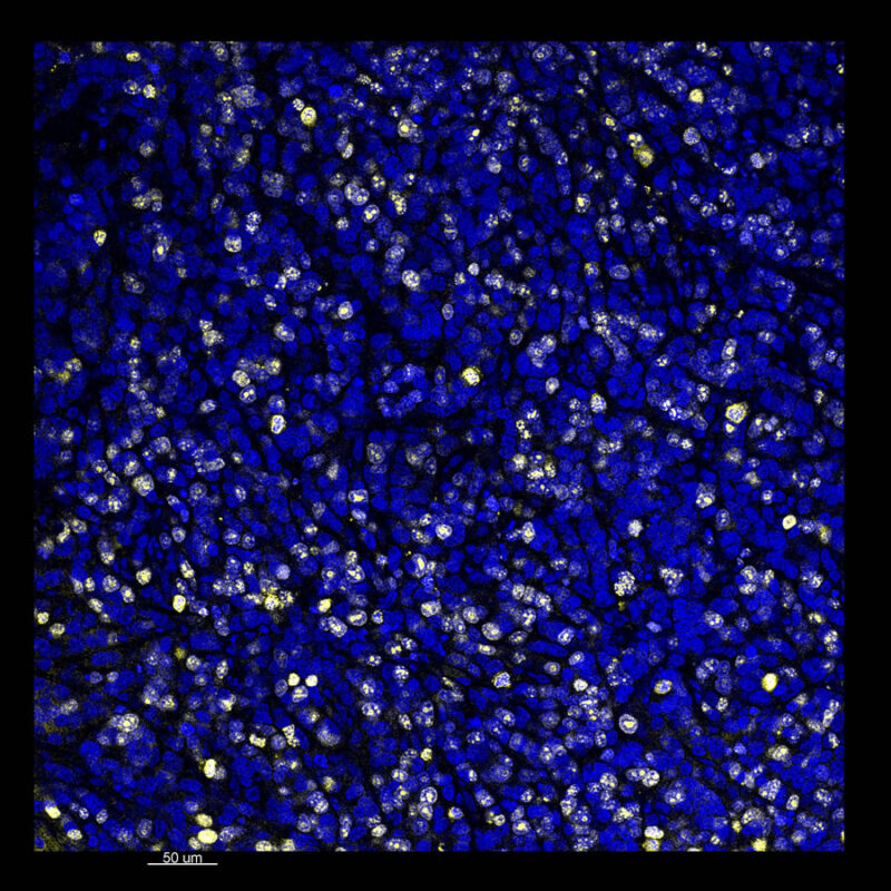 2D flat view of immunostained MCF7 mouse xenograft CLARITY processed sample for tissue clearing comparison