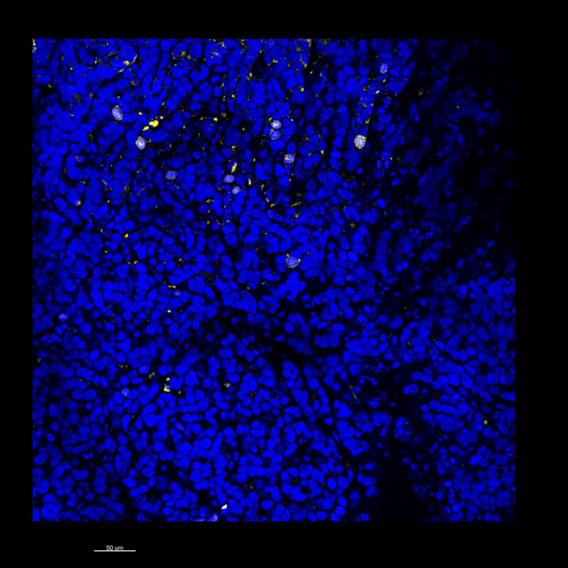 Immunostained image comparison MCF-7 mouse xenograft – Ki67 - CUBIC 2D
