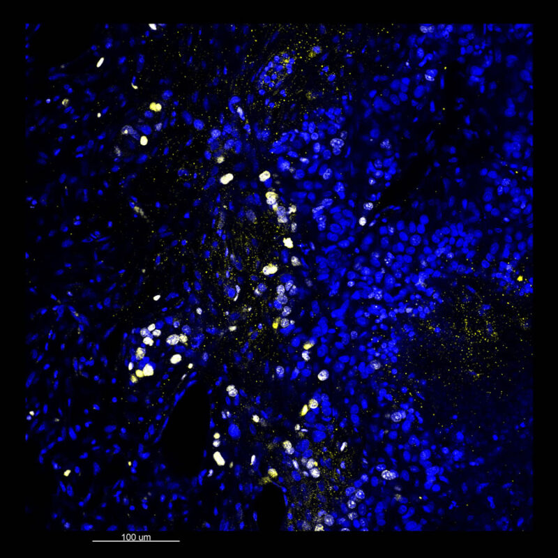 Immunostained image comparison MCF-7 mouse xenograft – Ki67 - Visikol 2D