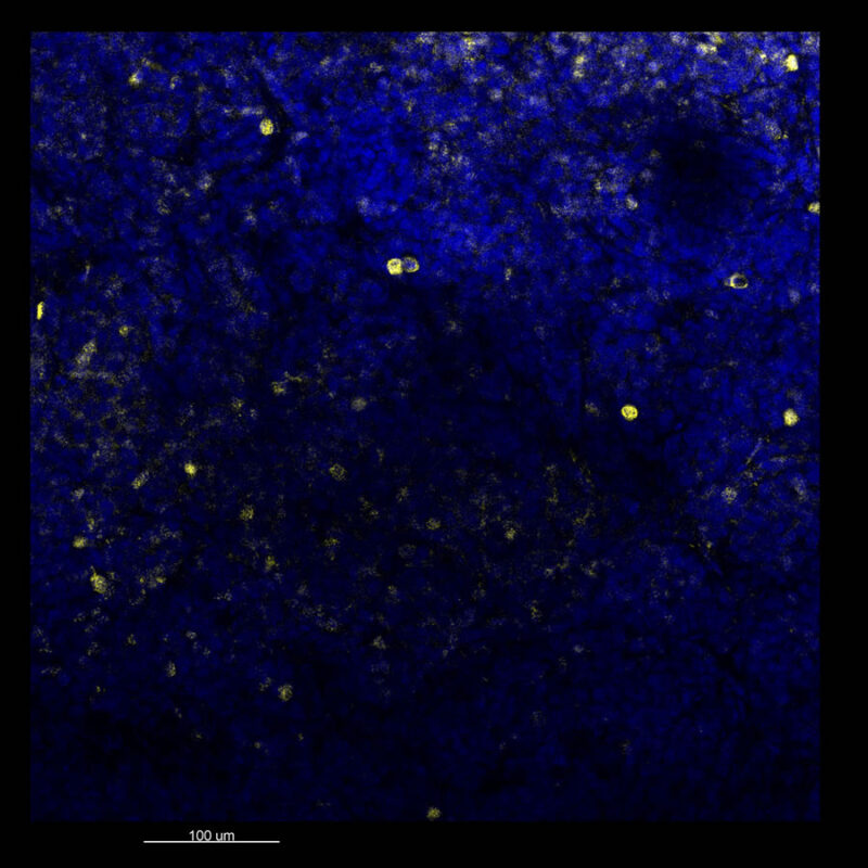 Immunostained image comparison MCF-7 mouse xenograft – Ki67 - iDISCO 2D
