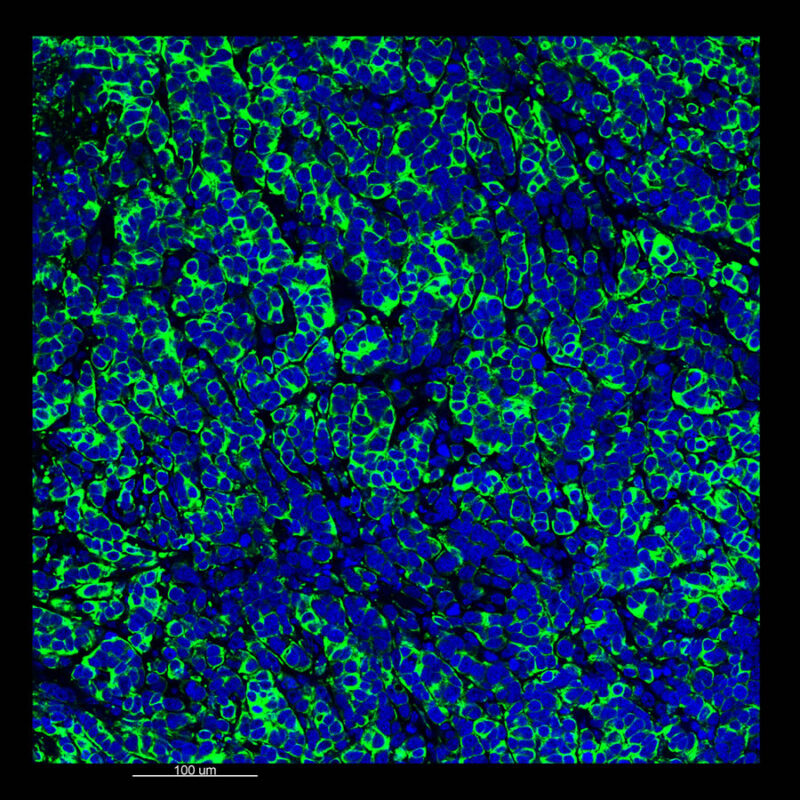 Immunostained image comparison MCF-7 mouse xenograft – pan-cytokeratin (pan-CK) - CLARITY ClearLight Flat