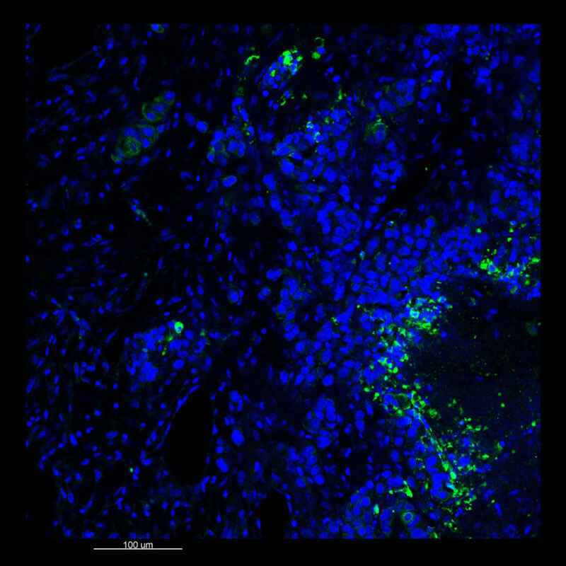 Immunostained image comparison MCF-7 mouse xenograft – pan-cytokeratin (pan-CK) - Visikol 2D