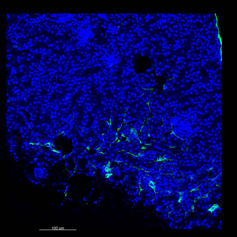 Immunostained image comparison Mouse kidney - α-smooth muscle actin - VISIKOL 2D