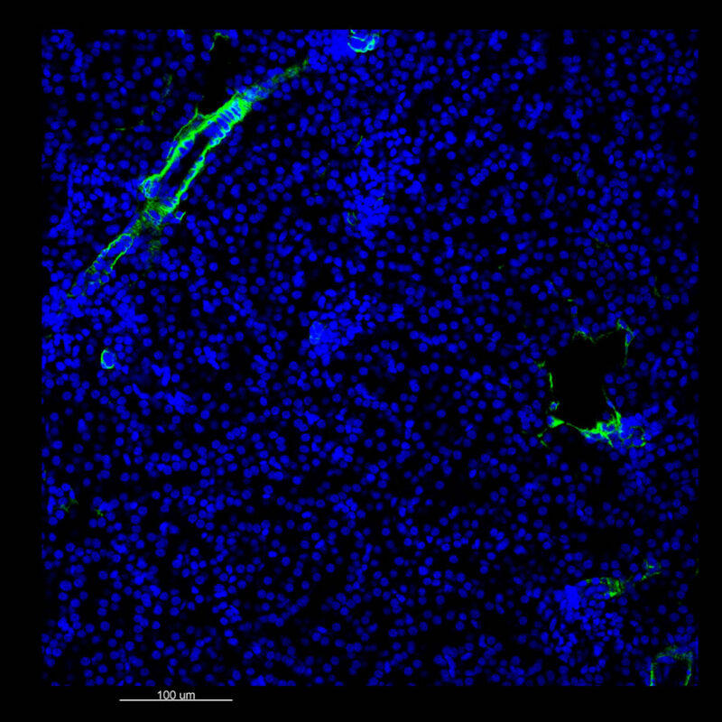 Immunostained image comparison Mouse kidney - α-smooth muscle actin - iDISCO 2D