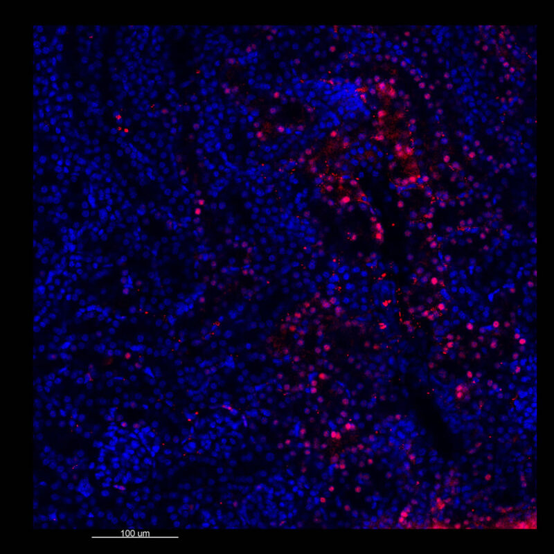 Immunostained image comparison Mouse kidney – PAX8 - CLARITY ClearLight 2D