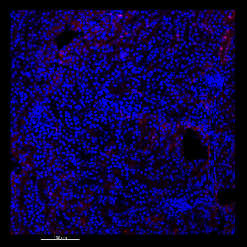 Immunostained image comparison Mouse kidney – PAX8 - iDISCO 2d