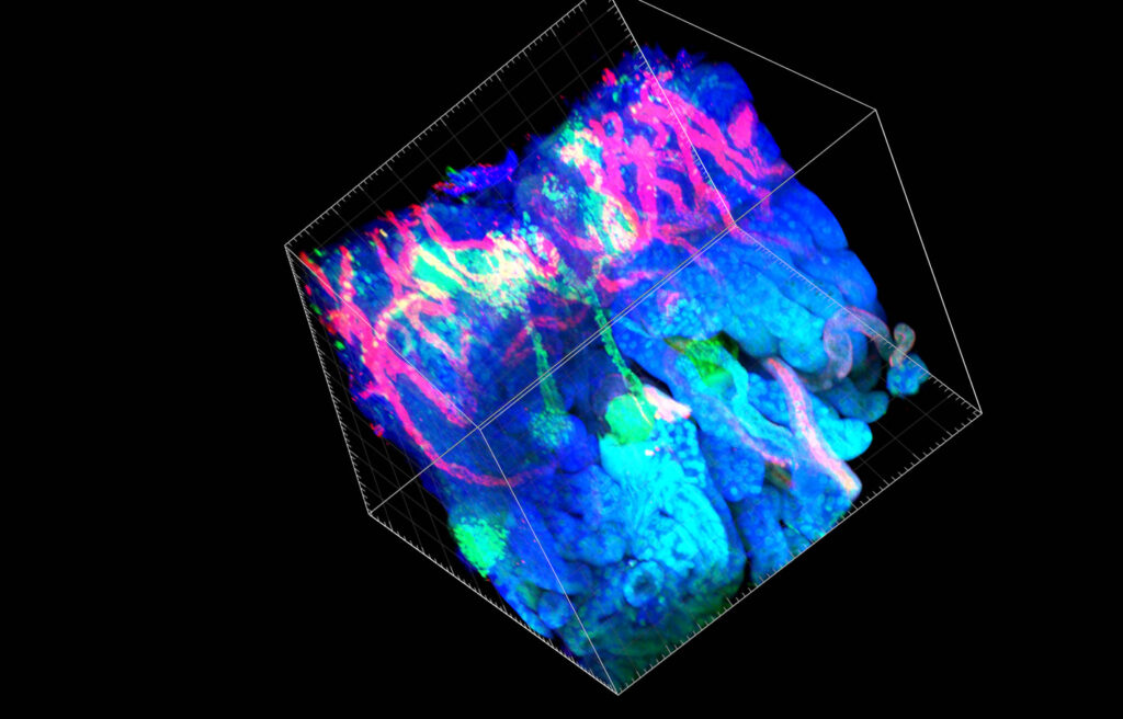 See More Biology in the Tissue Microenvironment