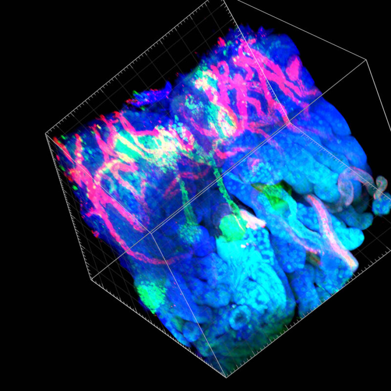 CLARITY Tissue Clearing Applications for 3D Brain Volume