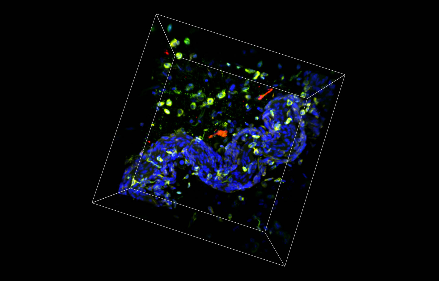 Image of mouse back skin with DAPI (blue), Beta-catenin (β-catenin) shown in green, Vimentin (yellow), and Pan-cadherin shown in red