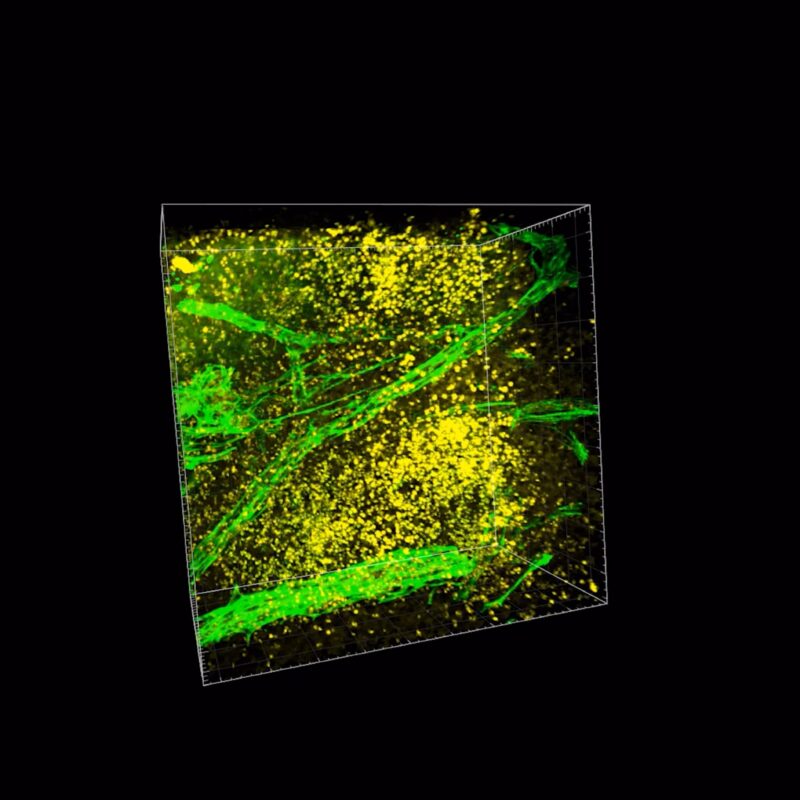 Tissue Microenvironment Imaged by ClearLight Bio