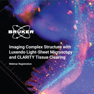 Bruker ClearLight Webinar - Light-Sheet and CLARITY Tissue Clearing